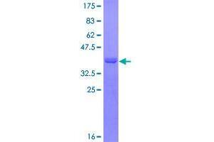 Image no. 1 for Caspase Recruitment Domain Family, Member 9 (CARD9) (AA 393-492) protein (GST tag) (ABIN1348065)