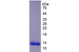 SDS-PAGE analysis of Human ADAMTS8 Protein. (ADAMTS8 Protéine)