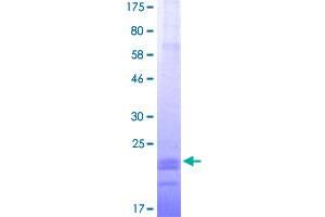 Image no. 2 for CD40 Ligand (CD40LG) (AA 116-261) protein (His-DYKDDDDK-Strep II Tag) (ABIN1348648)