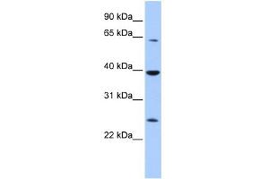 WB Suggested Anti-CIAO1 Antibody Titration:  0. (CIAO1 anticorps  (Middle Region))