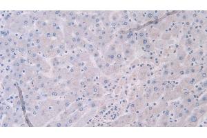 Detection of TNX in Human Liver Tissue using Polyclonal Antibody to Tenascin X (TNX) (TNXB anticorps  (AA 3835-4088))
