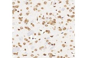 Immunohistochemistry analysis of paraffin-embedded mouse brain using,GSTT1 (ABIN7074091) at dilution of 1: 2000 (GSTT1 anticorps)