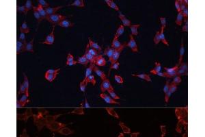 Immunofluorescence analysis of NIH-3T3 cells using GPC3 Polyclonal Antibody at dilution of 1:100 (40x lens). (Glypican 3 anticorps)