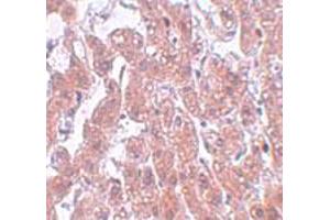 Immunohistochemical staining of human brain tissue with 5 ug/mL FAM59A polyclonal antibody . (FAM59A anticorps  (C-Term))
