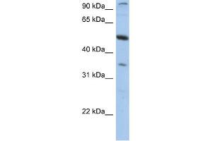 WB Suggested Anti-PLXDC1 Antibody Titration:  0. (PLXDC1 anticorps  (N-Term))