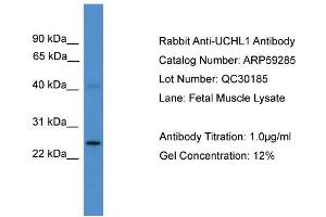 WB Suggested Anti-UCHL1  Antibody Titration: 0. (UCHL1 anticorps  (C-Term))