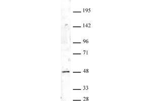 HOXA9 antibody (pAb) tested by Western blot. (HOXA9 anticorps  (N-Term))