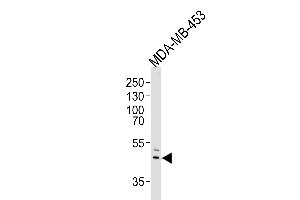 Western blot analysis of lysate from MDA-MB-453 cell line, using IL5RA Antibody (N-term) (ABIN651428 and ABIN2840234). (IL5RA anticorps  (N-Term))