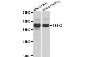 Western blot analysis of extracts of various cell lines, using TESK2 antibody (ABIN4905392) at 1:1000 dilution.