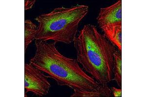 Image no. 1 for anti-Eukaryotic Translation Elongation Factor 1 alpha 1 (EEF1A1) antibody (ABIN329131)