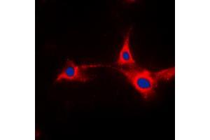 Immunofluorescent analysis of PFKFB2 staining in HepG2 cells. (PFKFB2 anticorps  (N-Term))