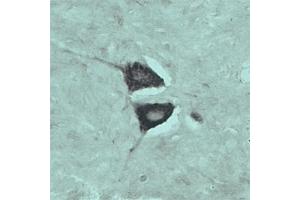 IHC on rat spinal cord using Rabbit antibody to internal part of Vacuolar protein sorting-associated protein 45 (rvps45, Vps45, Vps45a): IgG (ABIN351329) at a concentration of 10 µg/ml.