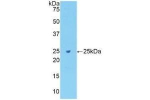 Detection of Recombinant Fibronectin, Rat using Polyclonal Antibody to Fibronectin (FN)