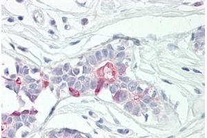 Image no. 3 for anti-Tumor Necrosis Factor, alpha-Induced Protein 8 (TNFAIP8) (AA 31-80) antibody (ABIN2879136) (TNFAIP8 anticorps  (AA 31-80))