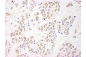 anti-Wolf-Hirschhorn Syndrome Candidate 2 (WHSC2) (AA 499-549) antibody