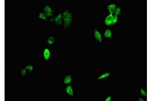anti-Cell Death-Inducing DFFA-Like Effector A (CIDEA) (AA 1-51) antibody