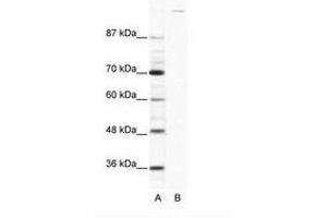 Image no. 1 for anti-Zinc Finger Protein GLI1 (GLI1) (AA 1007-1056) antibody (ABIN202974) (GLI1 anticorps  (AA 1007-1056))
