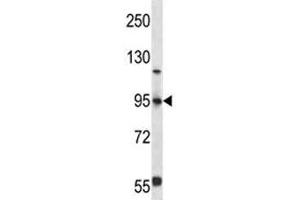 FOXP4 antibody western blot analysis in 293 lysate (FOXP4 anticorps  (AA 522-550))