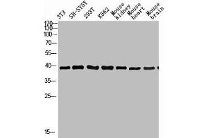 Western Blot analysis of various cells using Antibody diluted at 1:1000.