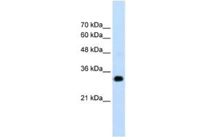 Western Blotting (WB) image for anti-Ring Finger Protein 121 (RNF121) antibody (ABIN2462677) (RNF121 anticorps)