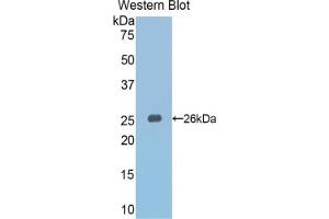 Detection of Recombinant Slit3, Mouse using Polyclonal Antibody to Slit Homolog 3 (Slit3)