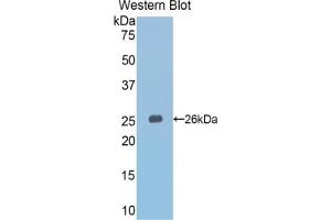 Detection of Recombinant Slit3, Mouse using Polyclonal Antibody to Slit Homolog 3 (Slit3) (SLIT3 anticorps  (AA 1348-1517))