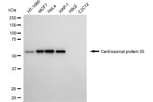 Western blotting analysis using centrosomal protein 55 antibody (ABIN7798025).