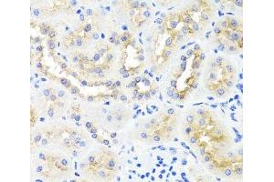 Immunohistochemistry of paraffin-embedded Rat kidney using ATP7A Polyclonal Antibody at dilution of 1:100 (40x lens). (ATP7A anticorps)