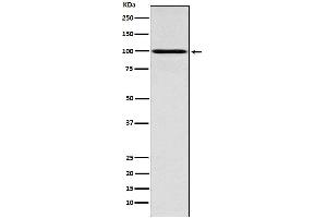 Western blot analysis of IFNGR1 expression in MCF7 cell lysate.