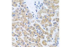 Immunohistochemistry of paraffin-embedded human liver using SCO1 antibody.