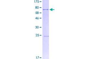 Image no. 1 for Sarcoglycan, epsilon (SGCE) (AA 1-437) protein (GST tag) (ABIN1319806)