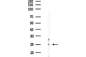anti-Progesterone Receptor Membrane Component 2 (PGRMC2) (C-Term) antibody