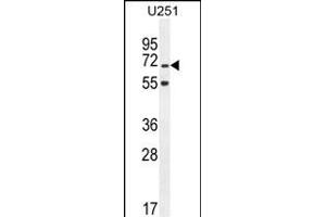 TNIP1 Antibody (C-term) (ABIN654978 and ABIN2844618) western blot analysis in  cell line lysates (35 μg/lane). (TNIP1 anticorps  (C-Term))