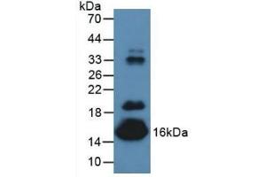 Detection of PALB in Mouse Serum using Polyclonal Antibody to Prealbumin (PALB) (TTR anticorps  (AA 21-147))