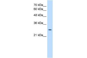 EBP antibody used at 0. (EBP anticorps)