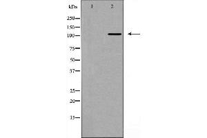 Western blot analysis of Integrin α3 (CD49c) expression in HepG2 cell,The lane on the left is treated with the antigen-specific peptide.