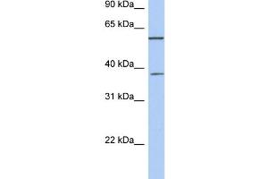 WB Suggested Anti-NUP43 Antibody Titration: 0. (NUP43 anticorps  (Middle Region))