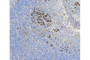 IHC analysis of COPE using anti-COPE antibody (ABIN7602509). (COPE anticorps  (AA 80-308))