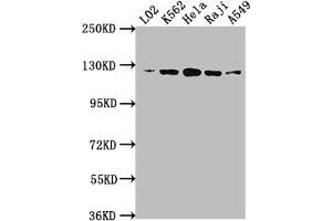 Western Blot Positive WB detected in: L02 whole cell lysate, K562 whole cell lysate, Hela whole cell lysate, Raji whole cell lysate, A549 whole cell lysate All lanes: ACLY antibody at 1:1500 Secondary Goat polyclonal to rabbit IgG at 1/50000 dilution Predicted band size: 121, 120, 92 kDa Observed band size: 120 kDa (Recombinant ACLY anticorps)