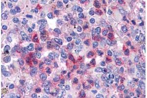 Human Spleen: Formalin-Fixed, Paraffin-Embedded (FFPE)