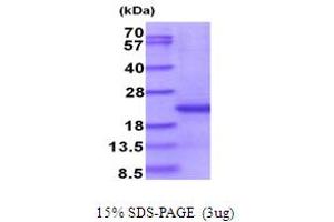 SDS-PAGE (SDS) image for CD300e Molecule (CD300E) (AA 18-173) protein (His tag) (ABIN5853943)