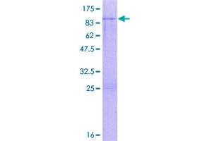 Image no. 1 for HNF1 Homeobox B (HNF1B) (AA 1-557) protein (GST tag) (ABIN1306850)