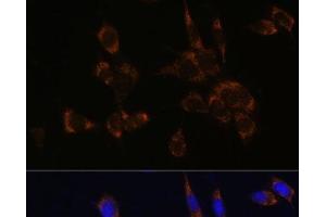 Immunofluorescence analysis of NIH/3T3 cells using Perforin Polyclonal Antibody at dilution of 1:100. (Perforin 1 anticorps)