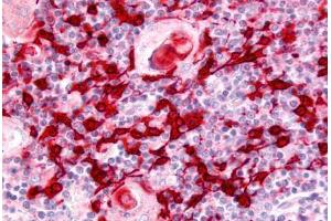 Human Thymus (formalin-fixed, paraffin-embedded) stained with USP4 antibody ABIN213586 at 5 ug/ml followed by biotinylated goat anti-rabbit IgG secondary antibody ABIN481713, alkaline phosphatase-streptavidin and chromogen. (USP4 anticorps  (Internal Region))
