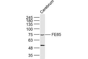 Lane 1: Mouse cerebrum lysates probed with FE65 Polyclonal Antibody, Unconjugated (bs-0110R) at 1:300 overnight at 4˚C. (FE65 anticorps  (AA 201-300))