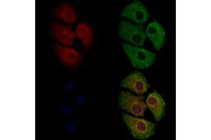 ABIN6262169 and ABIN6279682 staining Hela cells by IF/ICC. (HCN3 anticorps  (C-Term))
