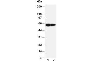 Western blot testing of IL-2 Receptor antibody and Lane 1:  PANC cell lysate ;  2: HeLa cell lysate. (IL2 Receptor beta anticorps  (AA 117-135))