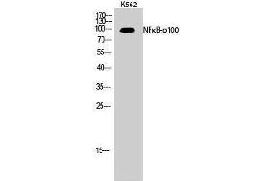 Western Blotting (WB) image for anti-Nuclear Factor of kappa Light Polypeptide Gene Enhancer in B-Cells 2 (NFKB2) (Thr160) antibody (ABIN3176318) (NFKB2 anticorps  (Thr160))
