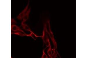 ABIN6276757 staining LOVO by IF/ICC.