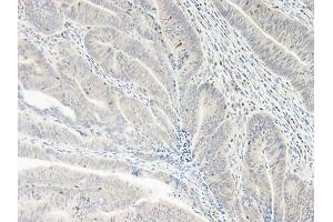 Image no. 2 for anti-Chemokine (C-X-C Motif) Ligand 5 (CXCL5) antibody (ABIN465535)